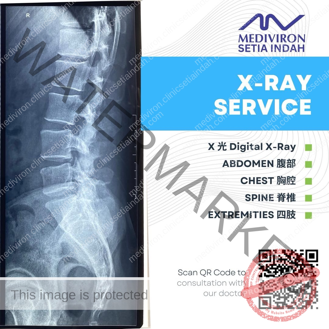 mediviron setia indah klinik x-ray injohor bahru
